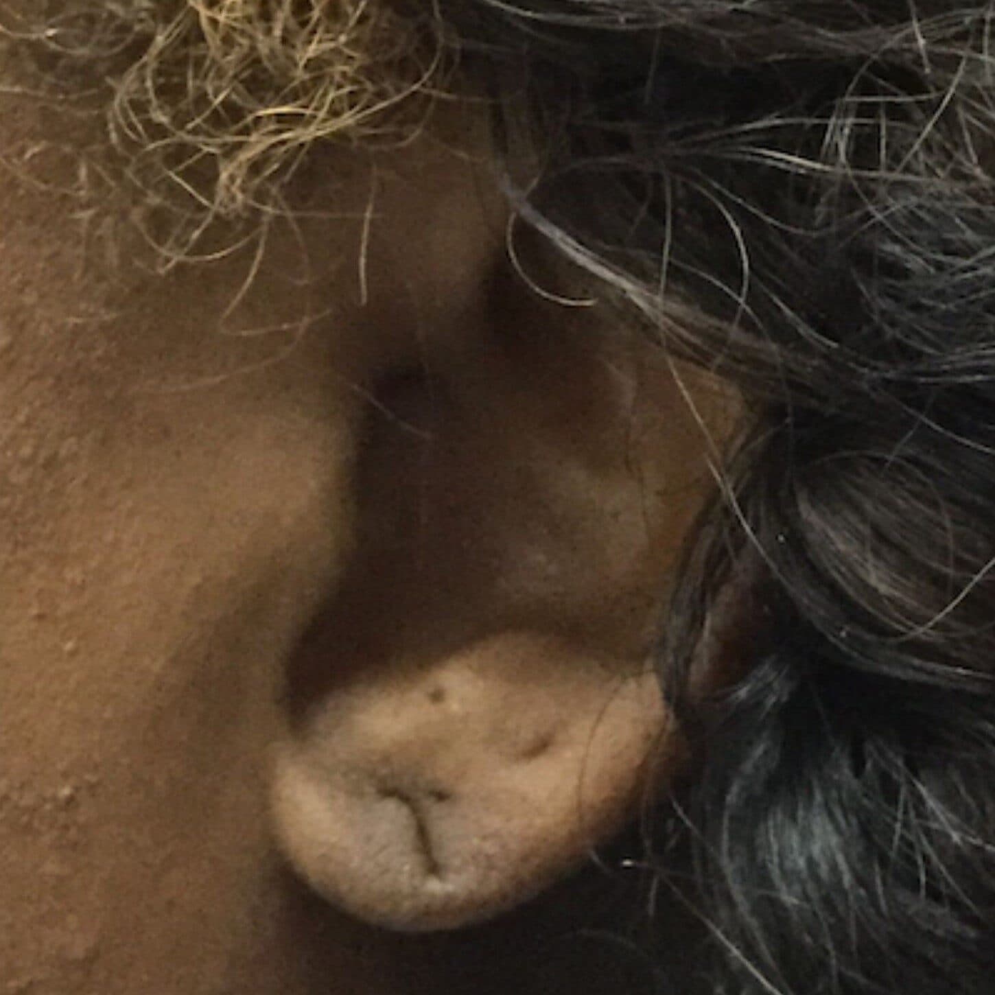 torn earlobe repair before